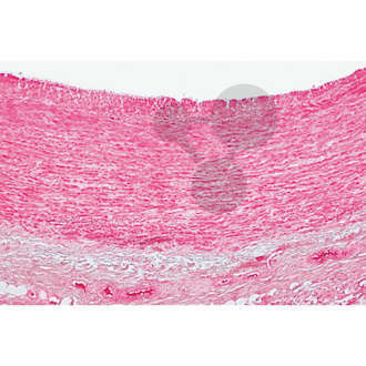 Série: Histologie: Organes vasculaires