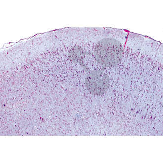 Série: Histologie: Système nerveux