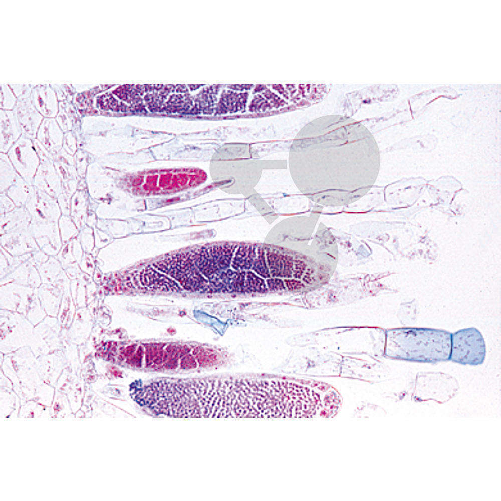 Prép. Micro. Mnium, anthéridies