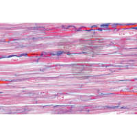 Prép. Micro. Muscle cardiaque