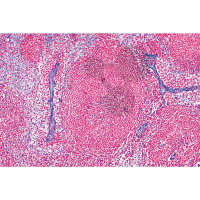 Série: Histologie: Système lymphatique