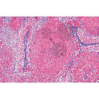 Série: Histologie: Système lymphatique