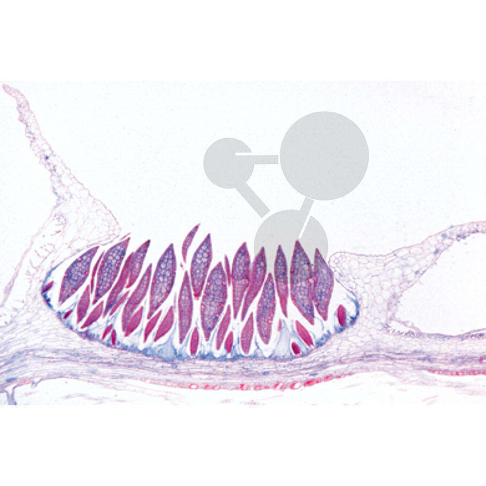 Prép. Micro. Marchantia, cupule avec cayeux