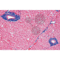 Prép. Micro. Pancréas, îlots de Langerhans